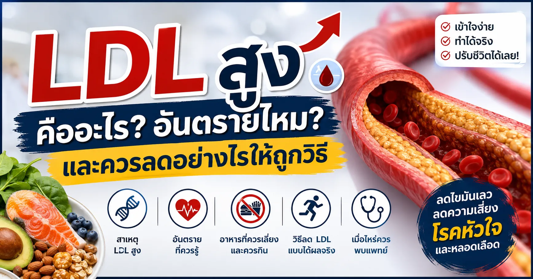 LDL สูง คืออะไร? อันตรายไหม และควรลดอย่างไรให้ถูกวิธี 1 high ldl